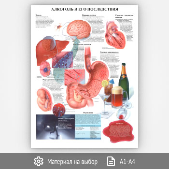 Плакат «Алкоголь и его последствия» (ЗОЖ-03, 1 лист)