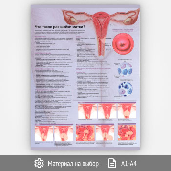 ������ ���� ����� ��� ����� �����?� (���-25, 1 ����)