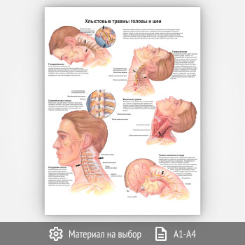 Плакат «Что такое ВИЧ и СПИД?» (ЗОЖ-40, 1 лист)